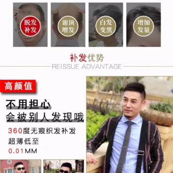 南陽(yáng)假發(fā)定制千絲美補(bǔ)發(fā)歡迎您